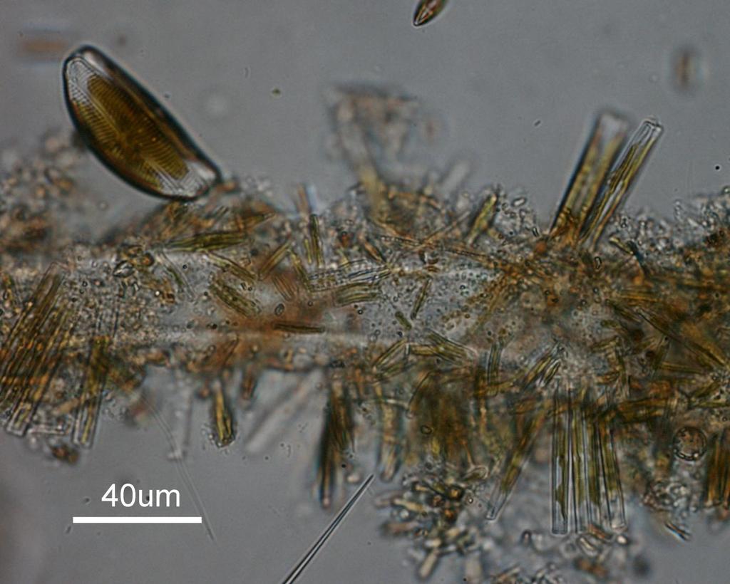 Bild 7. Kiselalger från 3,5 meters djup, bl. a syns Encyonema. Fragilaria, Gomphonema och Achnanthidium brunalger, båda ovanliga.