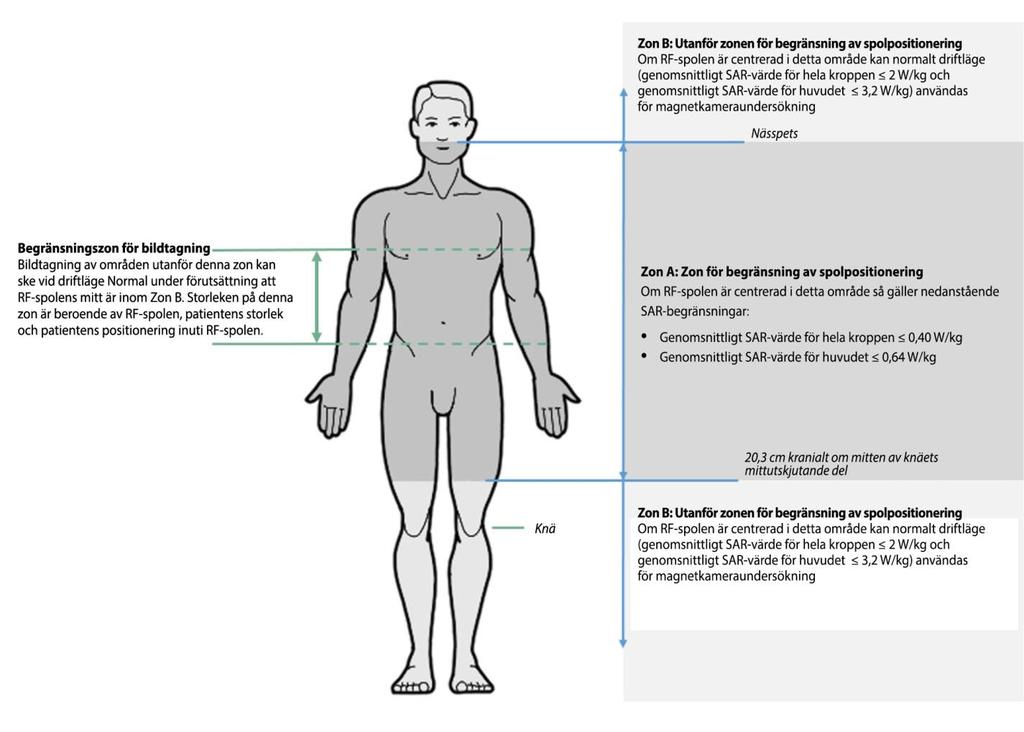 Figur 1: Zon för begränsning av spolpositionering. Med början från fotändan så startar zonen för begränsning av spolpositionering vid 20,3 cm kranialt om knäets mitt.