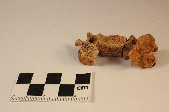 3.2 Grötlingbo Figur 42 är en halskota med huggskada över tvärutskottet och är även delad på mitten i samband med ett hugg.