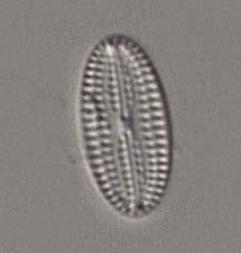 Figur 10. De näringskrävande arterna Planothidium delicatulum (övre t.