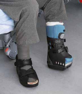 FOT- OCH FOTLEDSORTOSER Body Armor Pro Term En amputationsortos för tillfällig behandling efter Chopart eller Lisfranc amputationer. Ett alternativ under den första läkningsperioden.