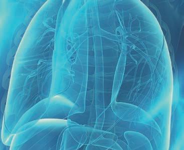 I Sverige har nu fler än 1 300 patienter behandlats med OPDIVO (nivolumab)1 MALIGNT MELANOM