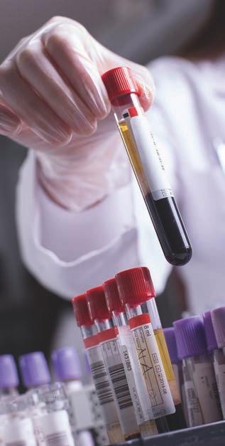 lungcancer Att använda vanliga rutinblodprover som prognostiska faktorer har också den fördelen att de är lättillgängliga och inte kräver dyra eller tidskrävande analyser. 7.