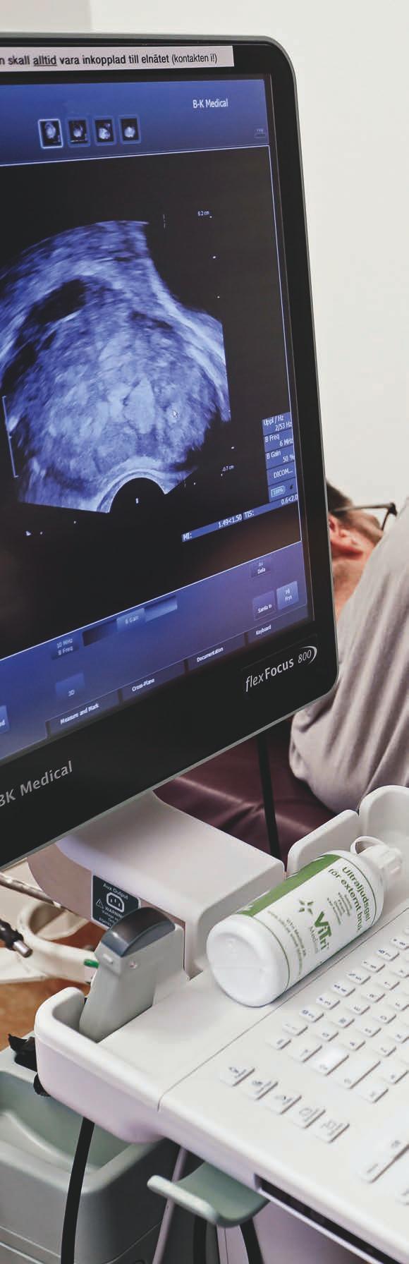 kliniken hematologi i fokus PSA-prov.