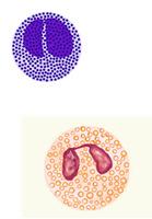Mot parasitangrepp Allergier 15 16 Medfödd immunitet celler NK-cell Cirkulerar i blodet Intracellullära patogener och cancerceller