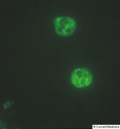 Immunofluorecens (IFL) C-ANCA