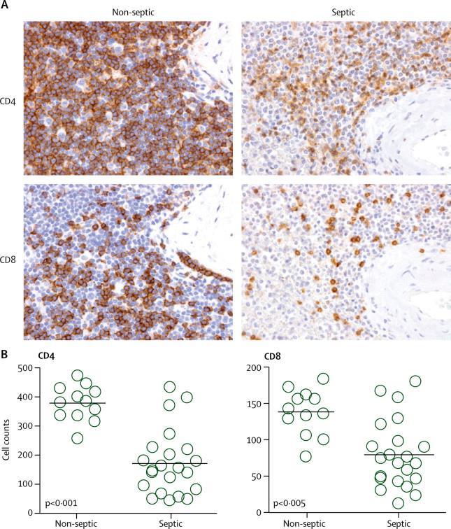 Immunsuppression vid sepsis Även det adaptiva försvaret