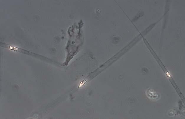Sjöarna längre ner i avrinningssystemet hade högre biomassor av växtplankton och större mängd cyanobakterier och andra näringsgynnade arter. Dessa sjöar fick huvudsakligen måttlig näringsstatus.