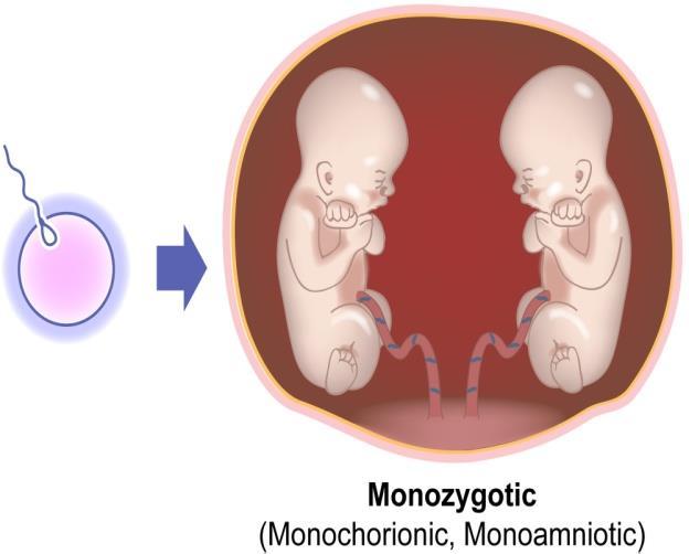 Alltid dichoriona Enäggs (monozygota), 1 + 1. Identiska.