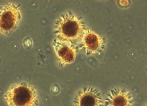 Växtplankton Per Olsson Inledning Växtplanktondynamiken studerades på två av hydrografistationerna, nämligen VH1 och K (se figur under hydrografi).