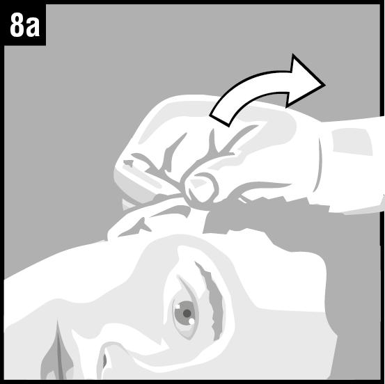 8a. För patienter med infektion i ytterörat: dra försiktigt örat uppåt och utåt. Detta gör att örondropparna kan rinna ned i hörselgången. 8b.
