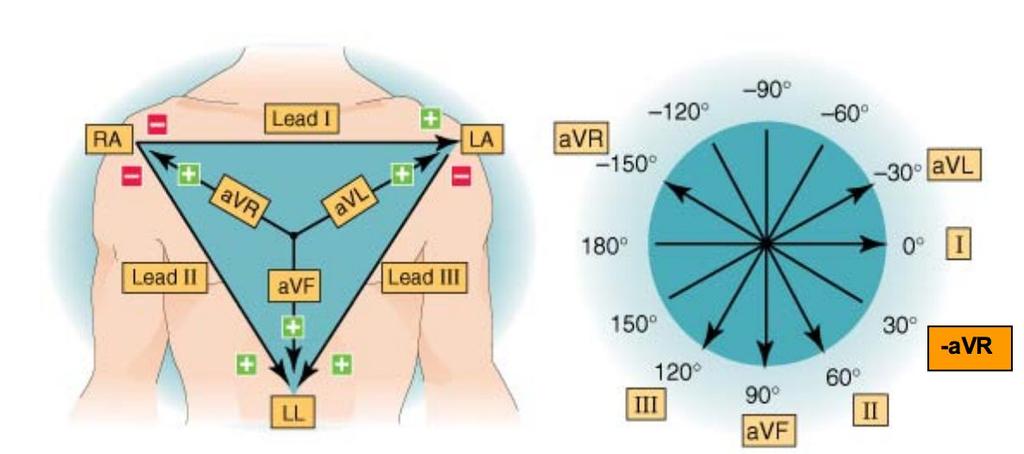 Hur kopplar man ett 12 avlednings-ekg? Avledningarna i transversalplanet mäts med unipolära bröstavledningar: vilket är avl, avr och avf. 1. Parasternalt I4 dx 2. Parasternal I4 sin 3.