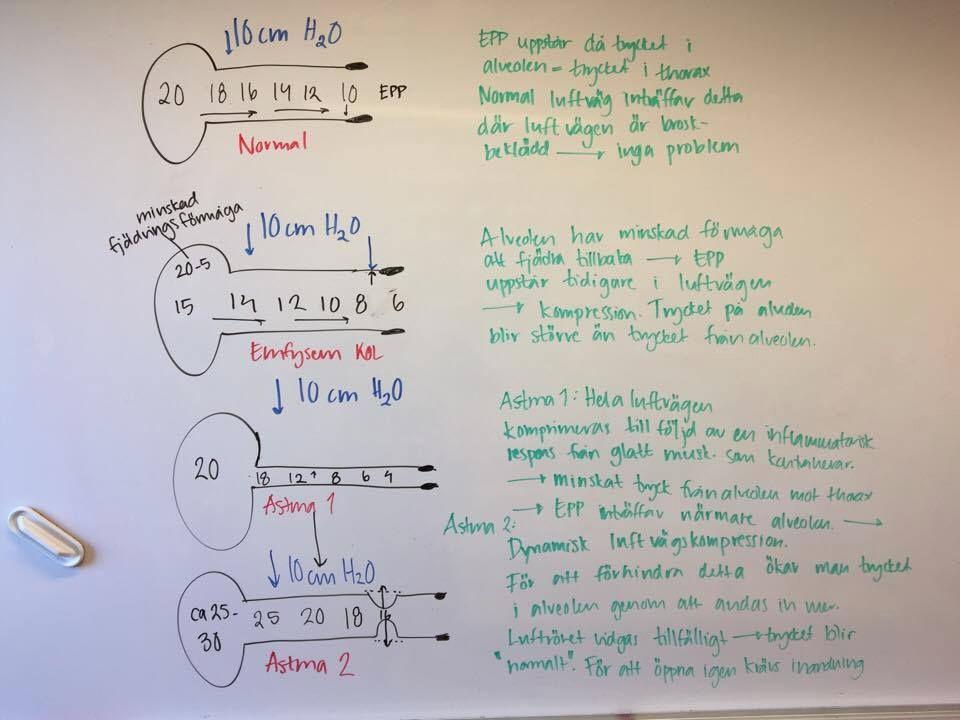 Trycket på alveolen utifrån blir högre än trycket som alveolen har mot interstitiet vilket gör att luftvägen faller ihop.