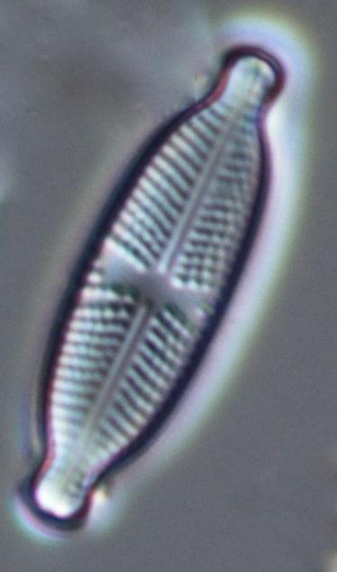 parvulum, Melosira varians, Navicula capitatoradiata, Navicula gregaria, Navicula tripunctata (framsidans foto), Nitzschia paleacea (figur 4), Nitzschia pusilla, Planothidium