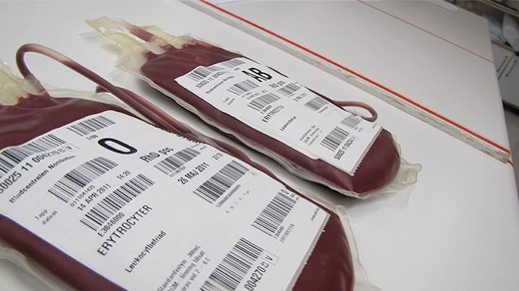 Blodet'till'IUT Färsktappat'O'neg'blod Matchad'mot'mamman'(Rhesus,'Kell,'Duffy)