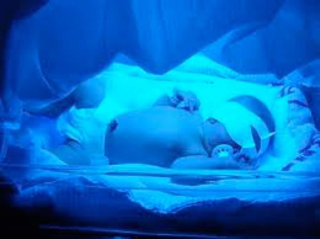 Behandling*av*det*nyfödda*barnet Ljusbehandling Utbytestransfusion Top:up*transfusioner IVIG*har*ingen*effekt* (neonatalt) Följ*upp*1:3*mån*