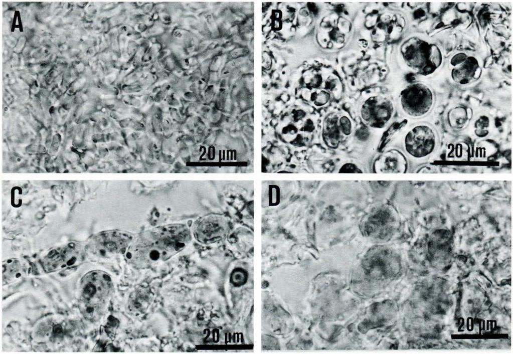 I 72 Leif Tibell SVENSK BOT. TIDSKR. 72 (1978) Fig I. Fykobionter hos Chaenotheca och Coniocybe. - A: Stichococcus från Chaenotheca trichia/is. - B: Chlorococcales från Chaenotheca chrysocephala.
