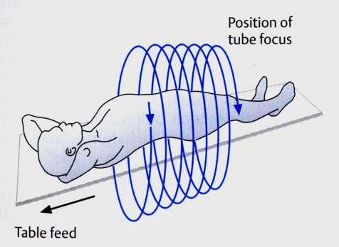 Spiral-CT - kontinuerlig bordsförflyttning och rör-detektorrotation -