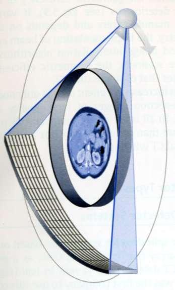 Spiral-CT Multidetektor-spiral-CT - spiral-ct med flera detektorrader - upp till 64 snitt / varv (128 snitt / sec) - drastisk