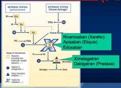 Antikoagulation vid endokardit } Fler pa2enter står på an2koagula2on (förmaksflimmer) } Behovet av bridging vid 2llfällig utsä@ning varierar med indika2on } Inte mycket känt om NOAK ( dabigatran,