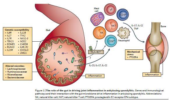 Proposed pathophysiology of AS AS patients have a distinct gut microbiome which is associated with genetic signature of AS This may activate the IL-23 pathway, possibly in combination with