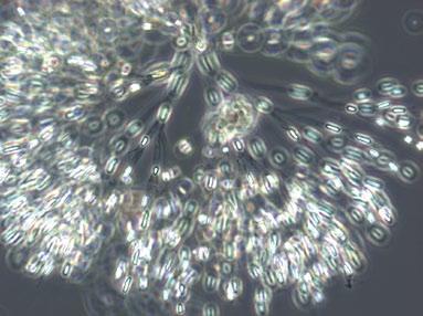 Detta är betydelsefullt för att information ska kunna nå allmänheten under t. ex. badsäsongen. Växtplankton varierar ca 1 gånger i storlek, från ca µm (tusendels mm) till 3- µm.