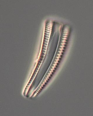 Planothidium frequentissimum, Platessa conspicua, Reimeria sinuata (Figur 5) och Rhoicosphenia abbreviata (Figur 5).