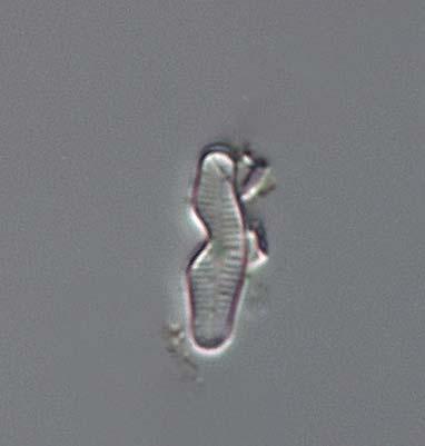 Figur 4. Exempel på missbildade skal av artgruppen Achnanthidium minutissimum från Oxundaån-Hargsån 2011. T.v. två missbildade skal med tydlig inbuktning. Längst t.h. ett normalt skal, Medins Biologi AB.