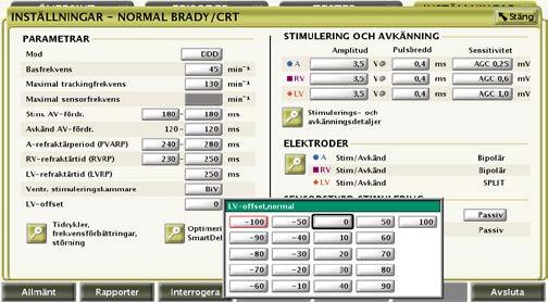Bilaga C: Navigering för programmeringsrekommendationer för produktrådgivningen om LV Offset från december 2017 För att eliminera risken associerad med tidigt utbyte av en berörd CRT-enhet för