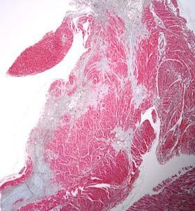 angiogenes.