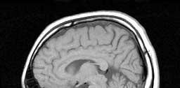 Ytterligare spektralanalys MRI Användbart i kommande