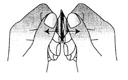 2. Riva av en tablettficka Varje blister innehåller sex tabletter som skiljs åt av en perforering. Riv av en tablettficka längs den streckade linjen (Figur 1). Fig. 1 3.