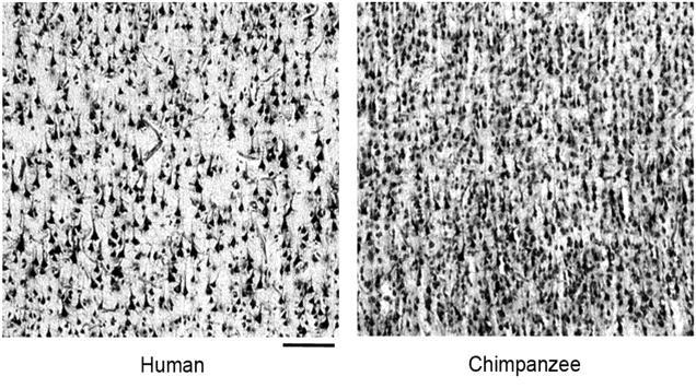 , 114, 224-241, 2001 Cladogram showing lateral views of the human and ape brain and horizontal