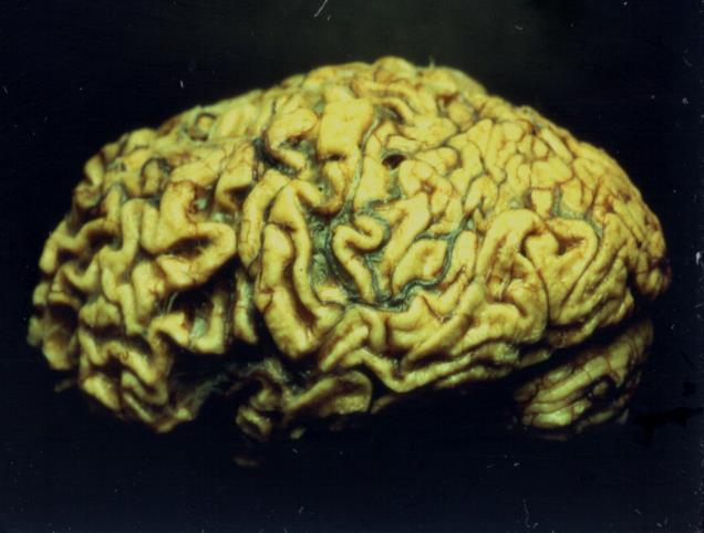 , 2005, Nature Neuroscience Nimchinsky