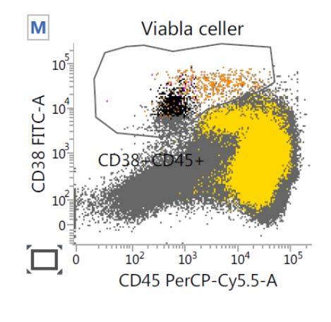 CD19dim CD56+ cyigl KLONAL?