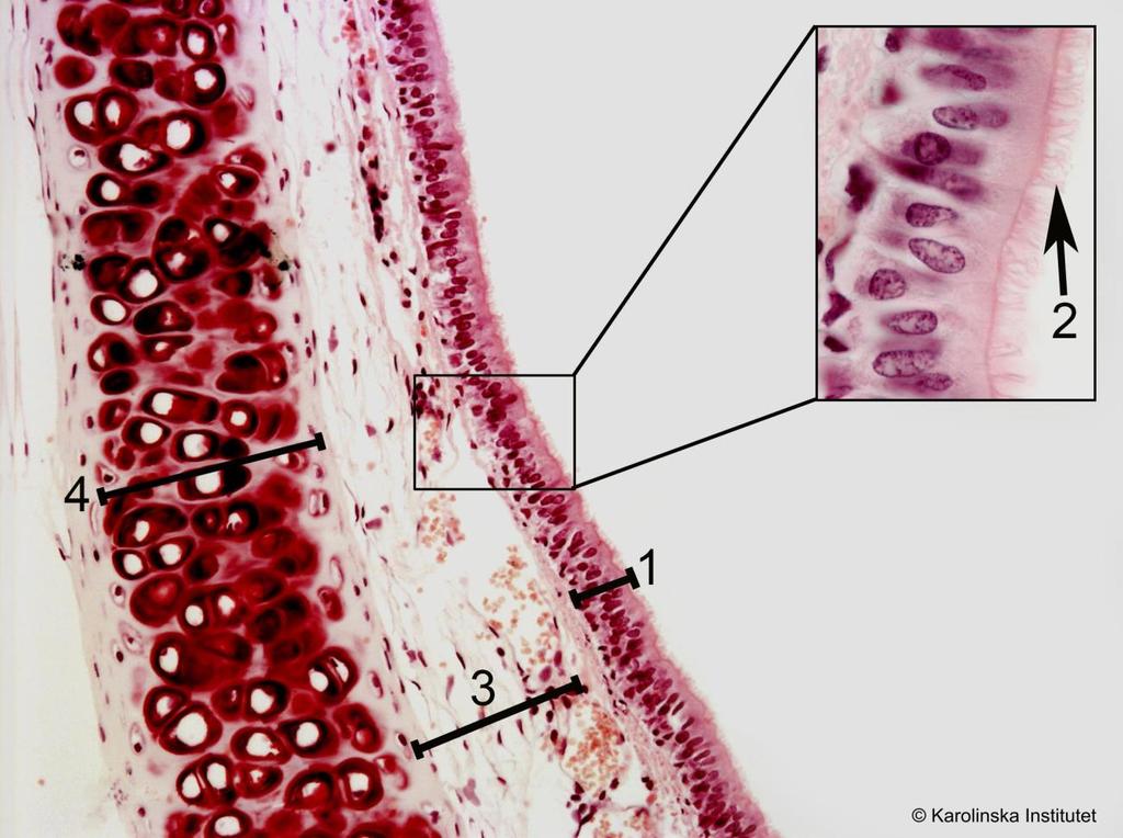 A2. Flerradigt cylindriskt epitel Htx-eosin 1. Lamina epitelialis 3. Bindväv 2. Kinocilier 4. Brosk Preparatet innehåller såväl trachea som esophagus. Bilden ovan visar enbart trachea.