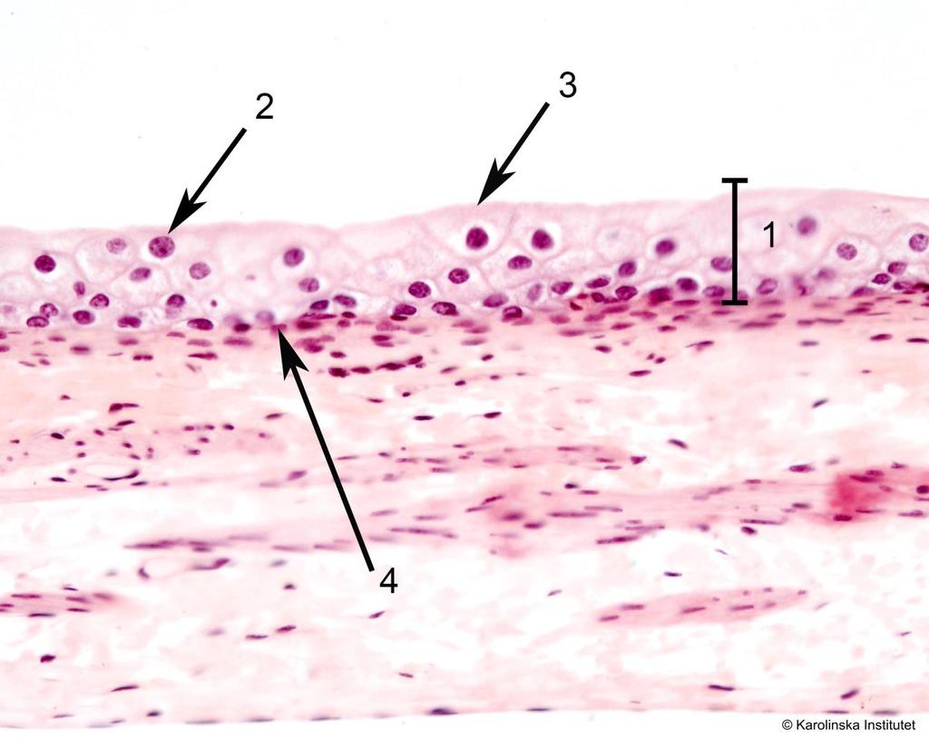 7. Övergångsepitel Htx-eosin 1. Lamina epitelialis 3. Krusta 2. Paraplycell 4. Basalmembran Övergångsepitel förekommer endast i urinvägarna. Det är ett skiktat epitel, dvs.
