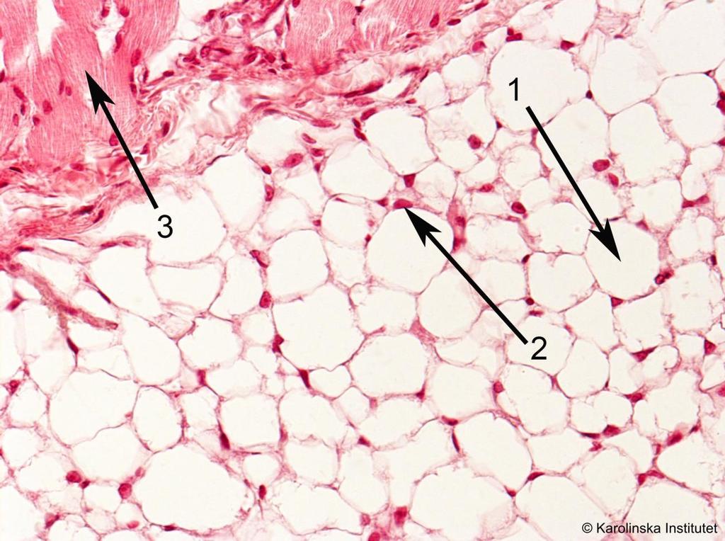 A8. Fettvävnad (marsvin) Htx-eosin 1. Fettcell 2. Cellkärna 3. Tvärstrimmig muskulatur För att påvisa fett använder man olika metoder t.ex. färgning med Sudanfärger eller osmiumtetroxid.