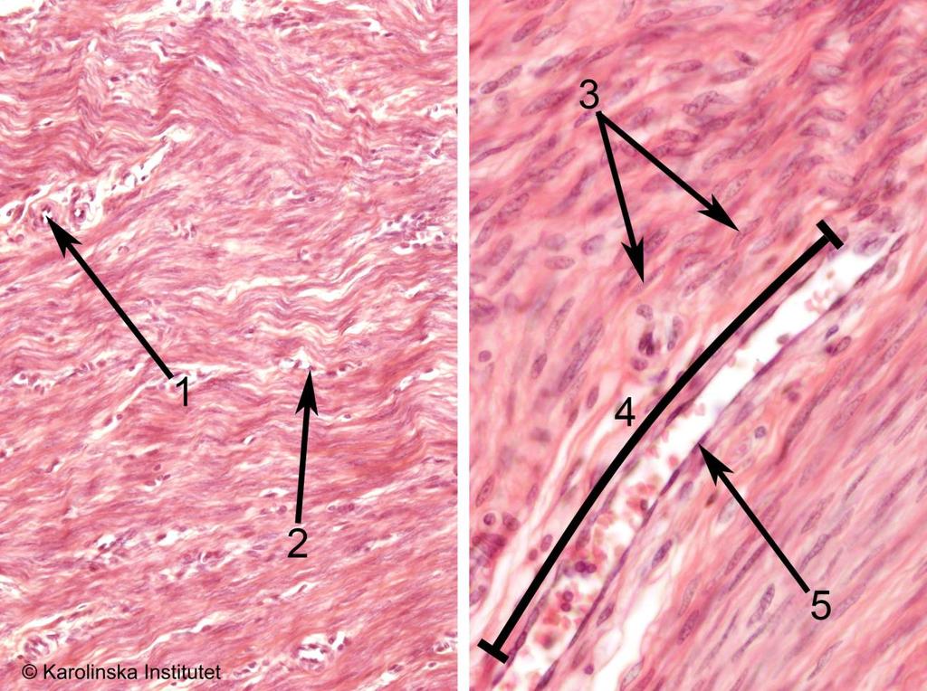 27. Glatt muskulatur (uterus) Htx-eosin 1. Kapillär 4. Kapillär 2. Fibroblast 5. Endotelcell 3.