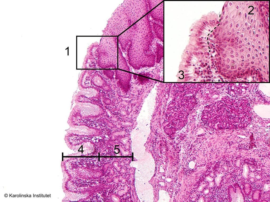 55. Esophagus ventriculus (övergång) Htx-eosin 1. Övergång mellan esophagus och ventriculus 4. Kryptor, foveolae 2. Skiktat skivepitel 5. Körtlar 3.