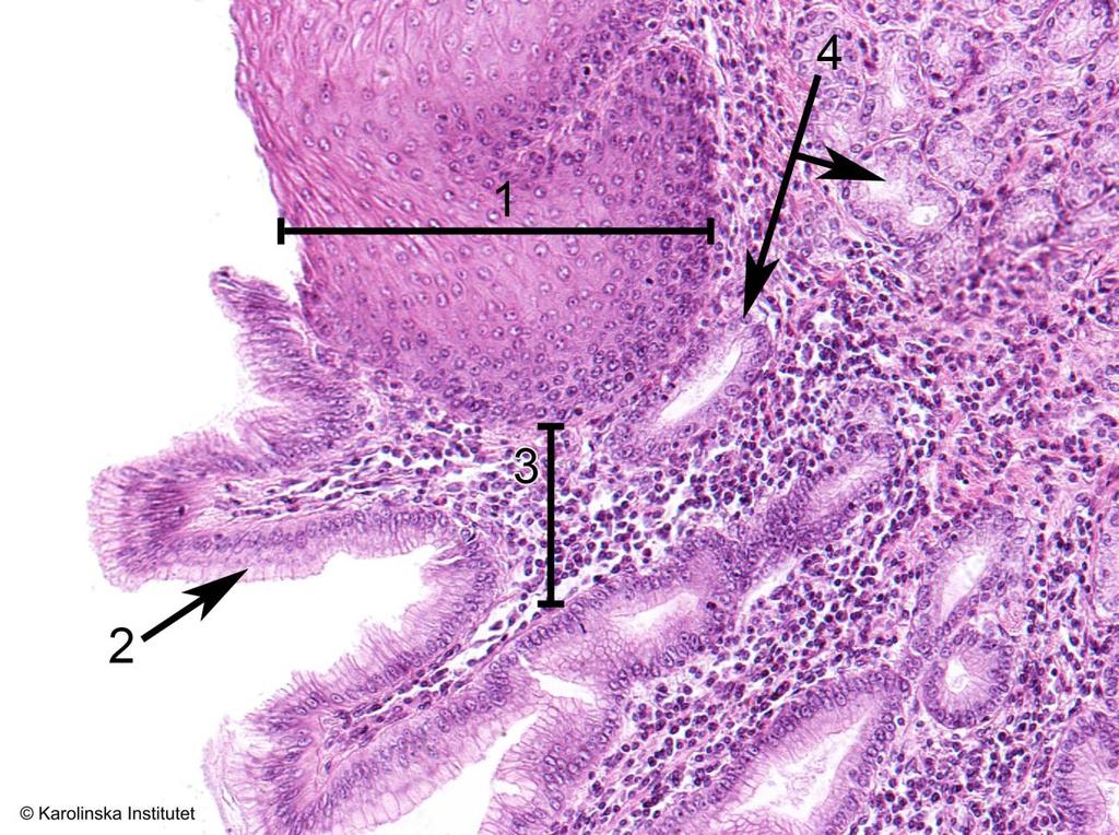 A57. Esophagus ventriculus (övergång) Htx-eosin 1. Skiktat skivepitel 3. Tela submucosa 2. Enkelt cylindriskt epitel 4.