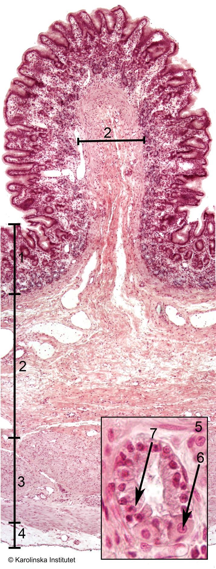 56. Ventriculus, pars corpus fundus Htx-eosin 1. Tunica mucosa (foveolae + hals + körtlar) 2. Tela submucosa 3. Tunica muscularis externa 4. Tunica fibrosa 5. Corpuskörtel 6. Parietalcell 7.