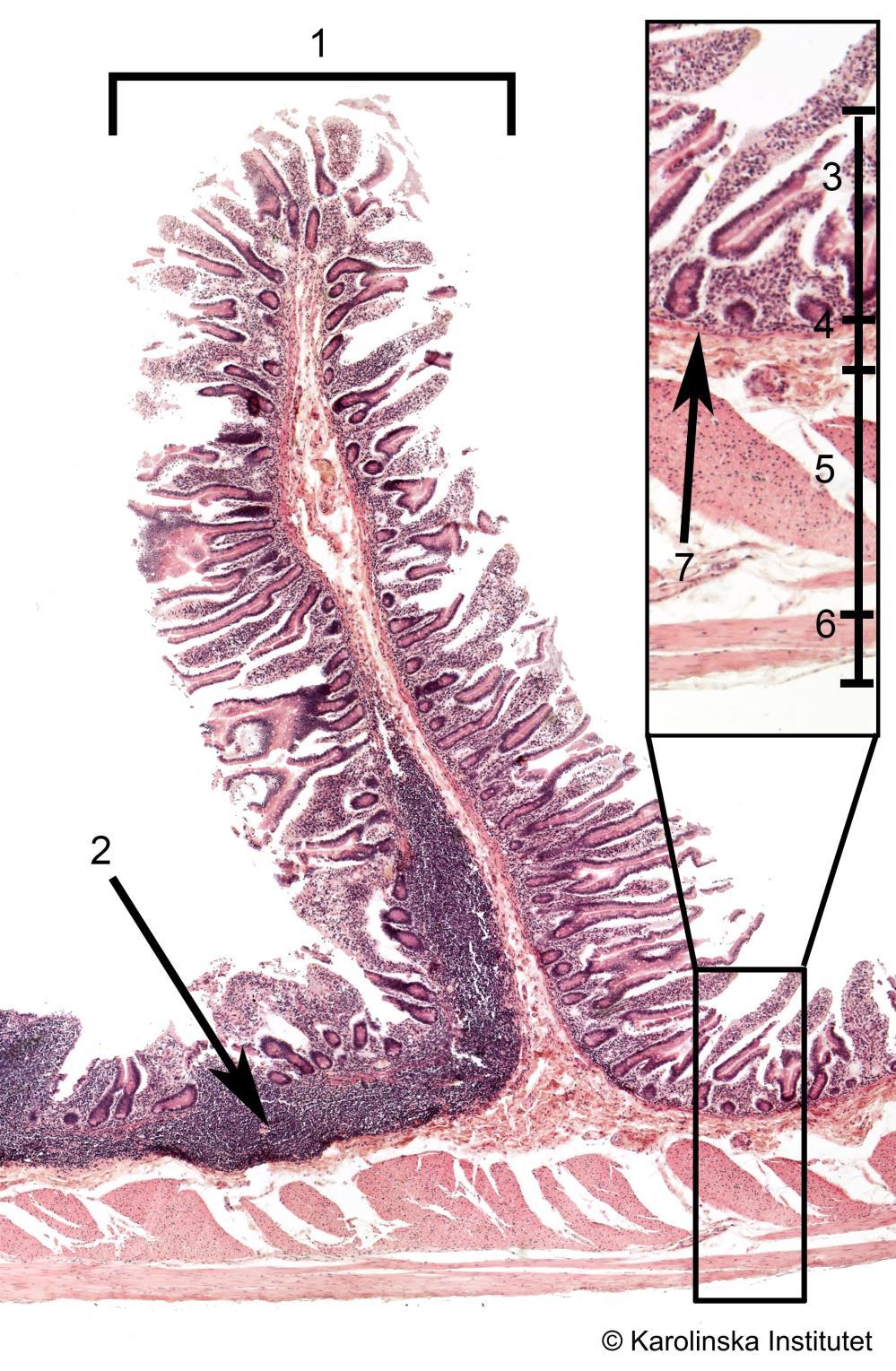 A62. Jejunum (homo), längdsnitt Htx-eosin 1. Plicae circulare 5. Lamina muscularis externa (c) 2. GALT; lymfocytansamling 6. Lamina muscularis externa (l) 3. Mukosa 7. Lamina muscularis mucosae 4.