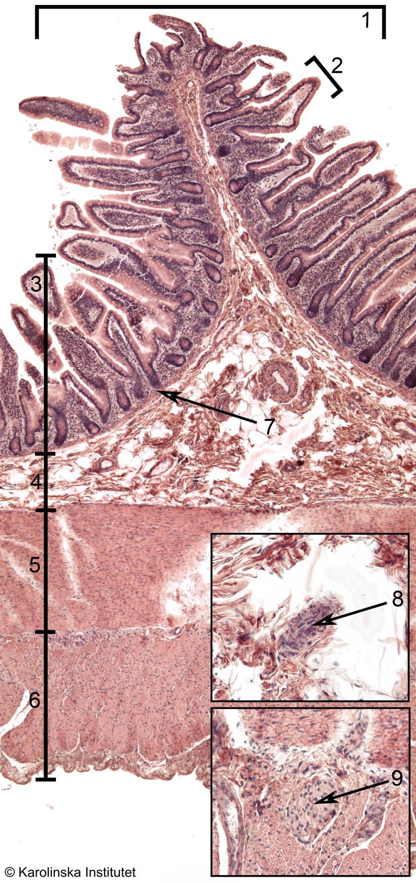 A63. Ileum, längdsnitt, (homo) FeCl3-Htx (Htx-eosin) 1. Plicae circulare 2. Villi 3. Tunica mucosae 4. Tela submucosa 5. Lamina muscularis externa (c) 6. Lamina muscularis externa (l) 7.
