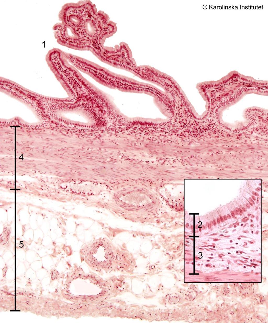 64. Vesica biliaris Htx-eosin 1. Slemhinneveck 4. Lamina muscularis externa 2. Cylindriskt epitel 5. Tunica serosa 3.