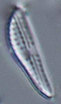 Amphora pediculus; t.v.