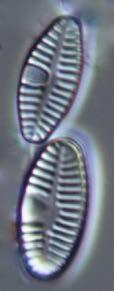Cocconeis placentula-komplexet från