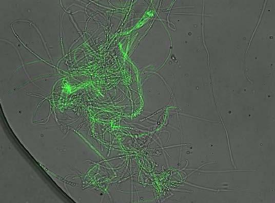 establishment B) Successful GFP transformation of N.