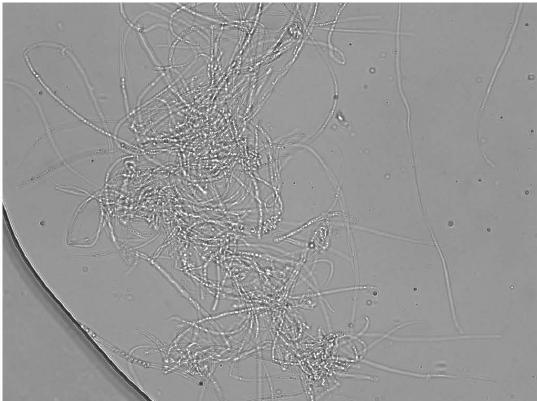 Verification of pathogenicity in progress C) First