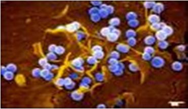 coli Staphylococcus aureus